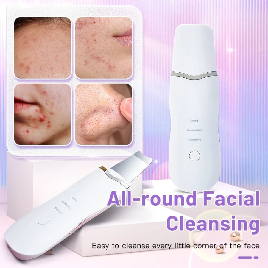 Electric Ultrasonic Facial Massager: Deep Cleansing, Blackhead Removal and Facial Lifting - Image 6