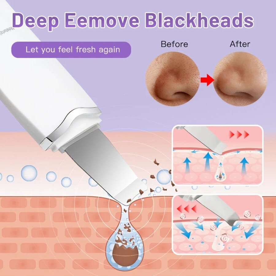 Electric Ultrasonic Facial Massager: Deep Cleansing, Blackhead Removal and Facial Lifting - Image 4