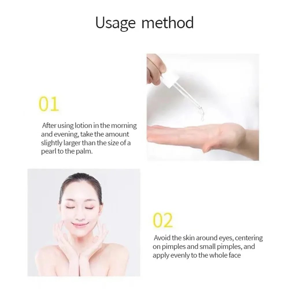 Suero potenciador de niacinamida y vitamina C Bright Complete 30x de Garnier, esencia blanqueadora para el tono de la piel, productos de belleza que atenúan las marcas del acné, 30 ml